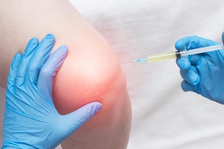 Joint Pain Injections